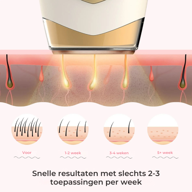 SmoothSkin l Haarlaser